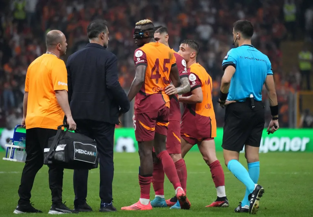 Osimhen absence limited Galatasaray's solutions – Okan Buruk