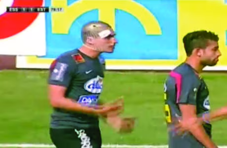 Tunisie : Bejaoui en sang lors du Clasico